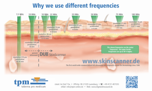 Different Frequencies DUB